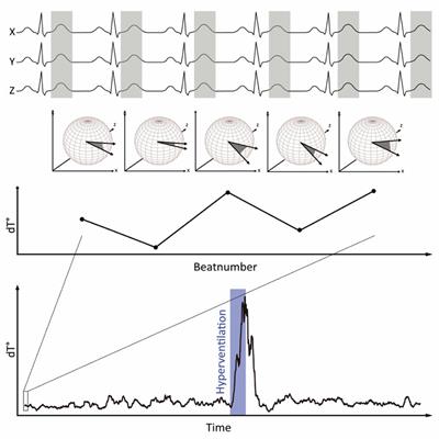 Effect of Hyperventilation on Periodic Repolarization Dynamics